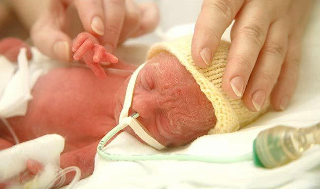 Your Premature Baby, their Brain, and Why Sleep Matters for Growth and Development